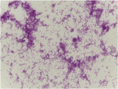 Postmenopausal Vaginal Microbiome and Microbiota